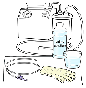 Insumos para la aspiración de una cánula de traqueostomía.